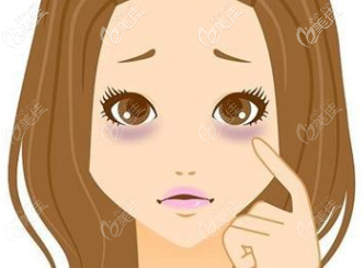 黑眼圈示意圖