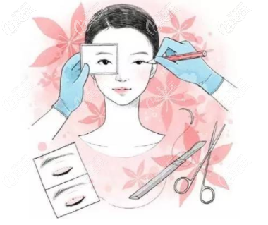 雙眼皮失敗評判標(biāo)準(zhǔn) 雙眼皮失敗評判標(biāo)準(zhǔn)