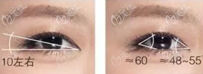 開(kāi)眼角大小角度