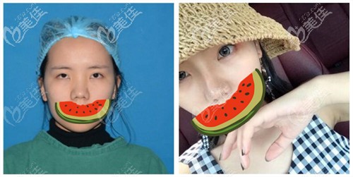 周亞超醫(yī)生案例