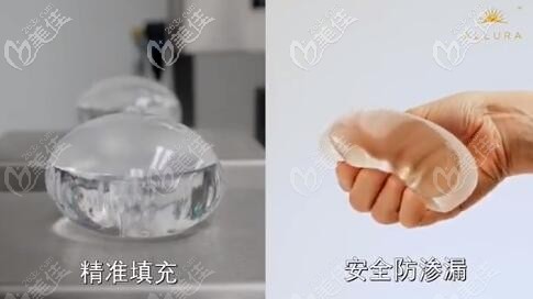 傲諾拉Xtra-星熠系列假體優(yōu)勢(shì)