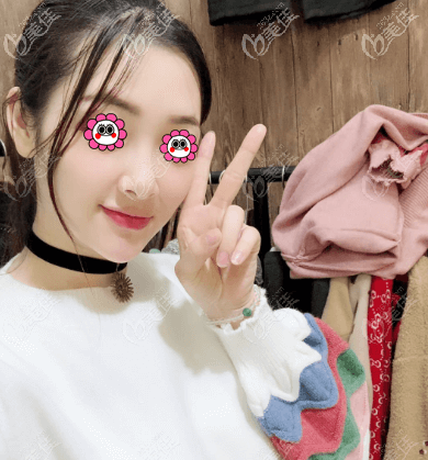 北京藝星超皮秒祛斑案例效果