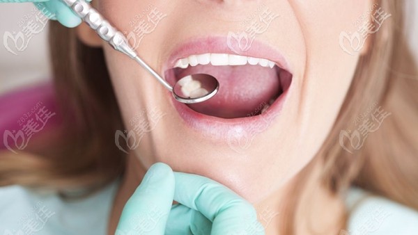 福州維樂口腔潔牙99元