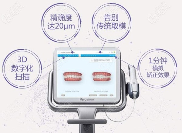 福州維樂口腔ITERO口掃