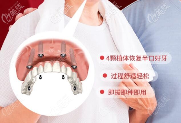 維樂半口allon4種植牙特點(diǎn)介紹