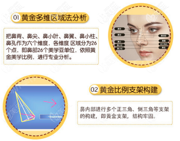 金成植醫(yī)生假體隆鼻手術(shù)技巧 金成植醫(yī)生假體隆鼻手術(shù)技巧