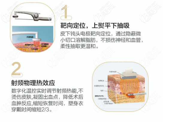 溶脂手術(shù)的作用原理