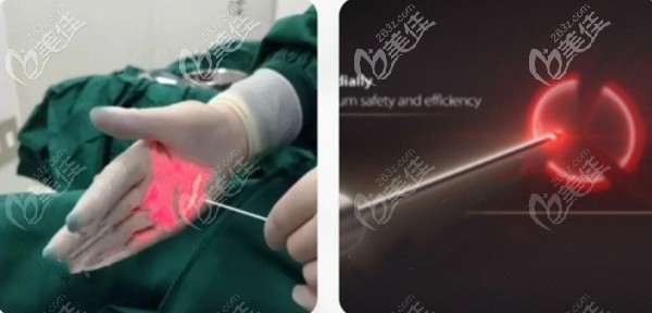 李法慶醫(yī)生擅長做5G天使光雕手術(shù) 李法慶醫(yī)生擅長做5G天使光雕手術(shù)