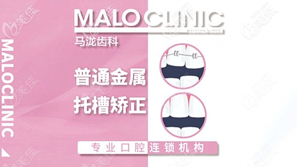 廣州馬瀧齒科收費價目表