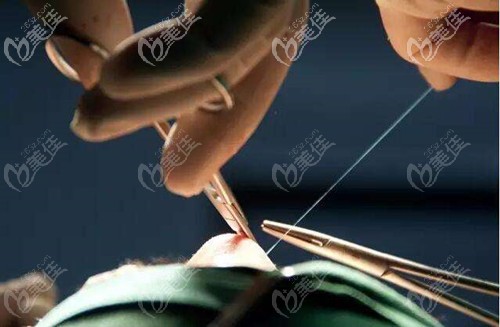 鼻失敗修復手術 鼻失敗修復手術