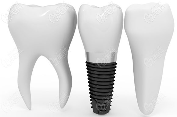 葛成院長還是諾貝爾種植品牌講師 葛成院長還是諾貝爾種植品牌講師