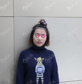 做注射隆鼻前 做注射隆鼻前