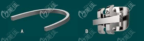 全同步帶狀弓牙套的價格