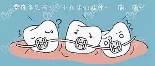 全同步帶狀弓矯正器的缺點