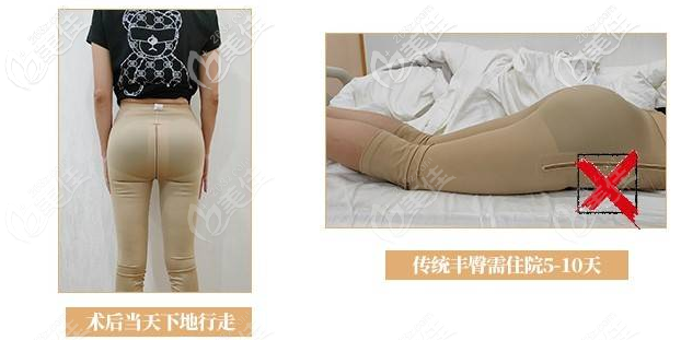 深圳曹孟君豐臀7天就可以正常坐臥行走