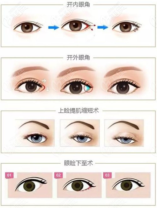 胥振眼綜合 胥振眼綜合