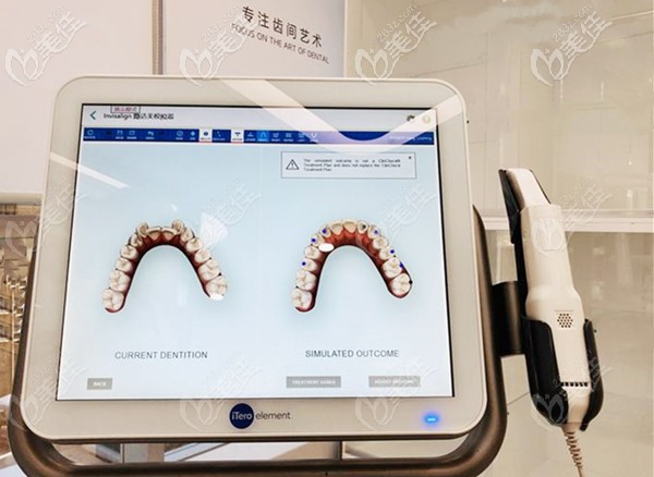 價(jià)值十多萬(wàn)的iTero口腔掃描儀 價(jià)值十多萬(wàn)的iTero口腔掃描儀