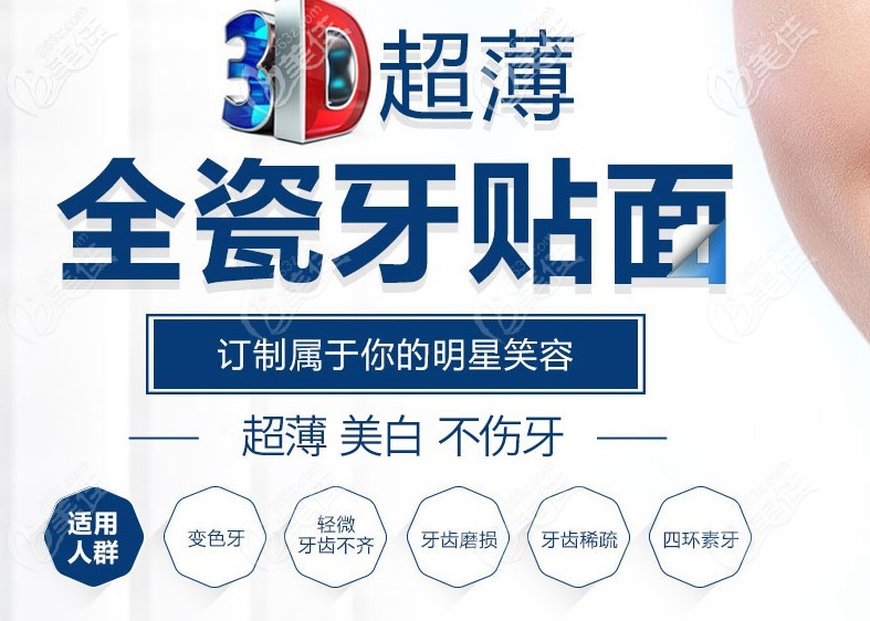 3D超薄全瓷牙貼面優(yōu)勢介紹