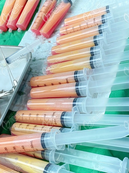 無限蘭斯瘦大腿吸脂22管