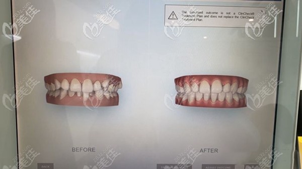 馬瀧齒科正畸效果圖