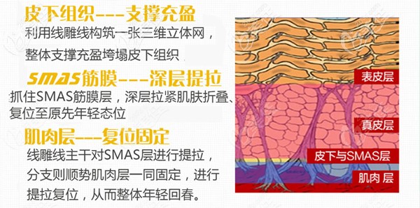 <!--<i data=20240703-sp></i>-->SMAS埋線提升技術(shù)優(yōu)勢(shì)