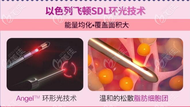 以色列飛頓SDL環(huán)光技術(shù)吸脂優(yōu)勢(shì)