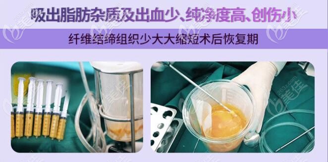 吸出的脂肪純度更高