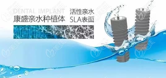 康盛親水種植體的外觀