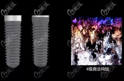 CAMLOG種植體材料 CAMLOG種植體材料