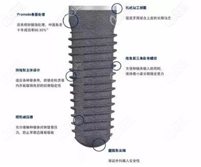 德國(guó)CAMLOG種植體優(yōu)勢(shì) 德國(guó)CAMLOG種植體優(yōu)勢(shì)