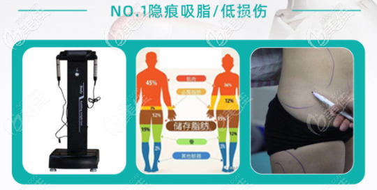 李烈醫(yī)生吸脂是哪個醫(yī)院 李烈醫(yī)生吸脂是哪個醫(yī)院