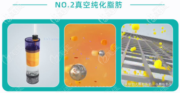 李烈醫(yī)生吸脂怎么預(yù)約 李烈醫(yī)生吸脂怎么預(yù)約