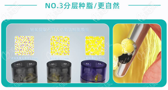 李烈醫(yī)生吸脂騙人 李烈醫(yī)生吸脂騙人