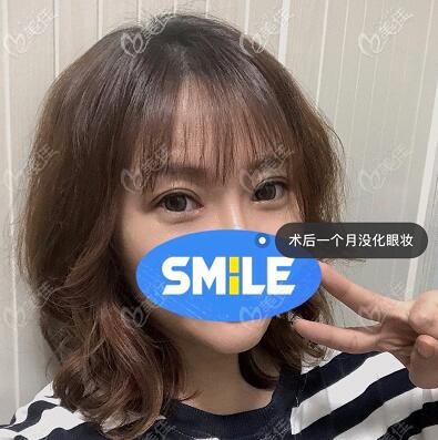 眼修復(fù)術(shù)后一個(gè)月照