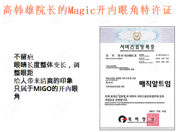 Magic開內(nèi)眼角術(shù)