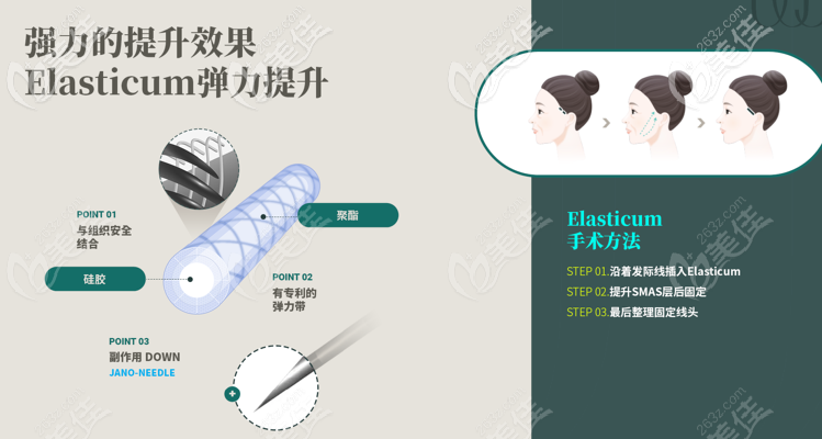 Elasticum提升術(shù)的優(yōu)勢 Elasticum提升術(shù)的優(yōu)勢