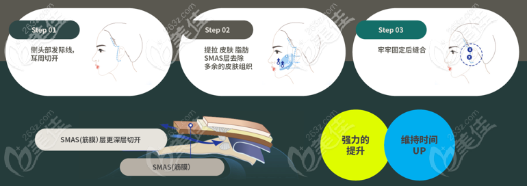 韓國原辰smas拉皮手術(shù)方法 韓國原辰smas拉皮手術(shù)方法