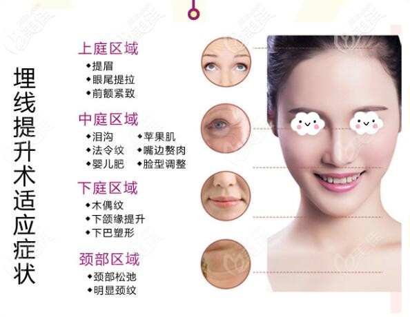 大同清木埋線提升術適應癥狀