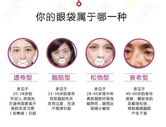 不同的眼袋類型，適合不同的去眼袋方法