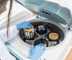 脂肪離心萃取脂肪膠示意圖