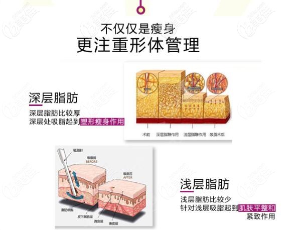 大同清木<!--<i data=20240703-sp></i>-->吸脂方式圖解