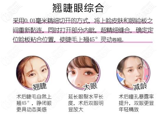 大同清木雙眼皮優(yōu)勢