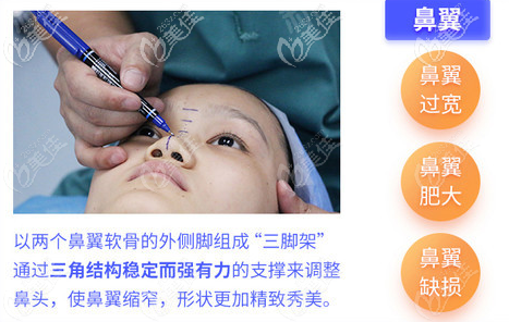 珠海韓妃周國(guó)偉醫(yī)生隆鼻技術(shù)優(yōu)勢(shì)