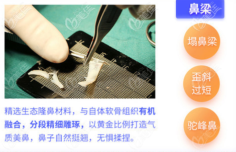 珠海韓妃周國(guó)偉鼻假體雕刻過程