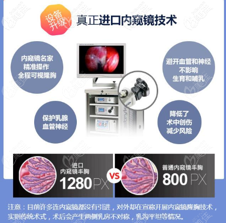 內(nèi)窺鏡技術(shù)的升級版軟窺鏡術(shù)