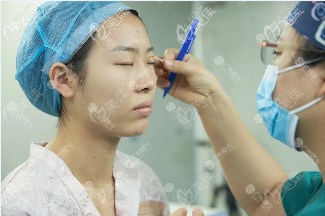 廣州雙眼皮修復(fù)醫(yī)院我推薦廣州曙光整形醫(yī)院