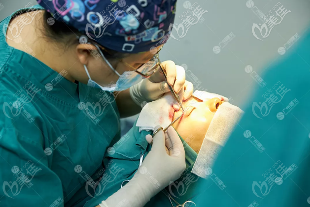 廣州曙光范丹醫(yī)生雙眼皮修復(fù)技術(shù)了得