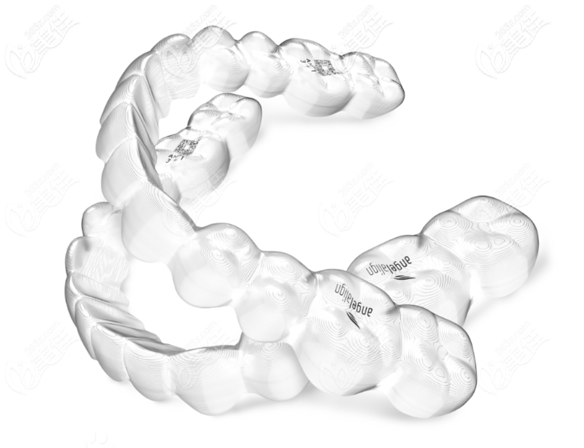 國產(chǎn)時代天使隱形矯正