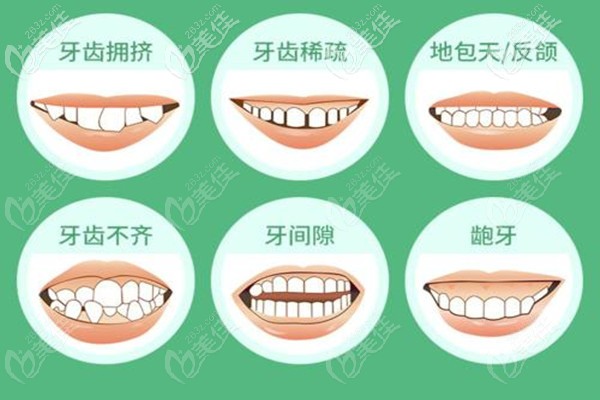 大連牙齒矯正大概要花費(fèi)多少錢