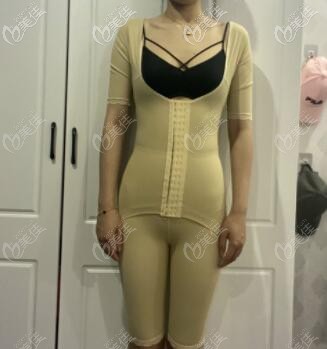 腰腹吸脂術(shù)后3天照